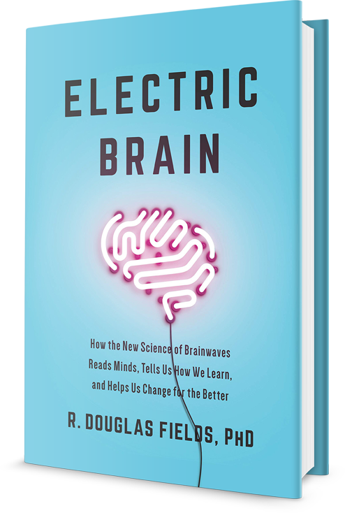 Electric Brain 3D